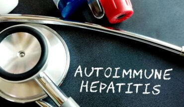 autoimuni hepatitis – uzrok, simptomi, liječenje