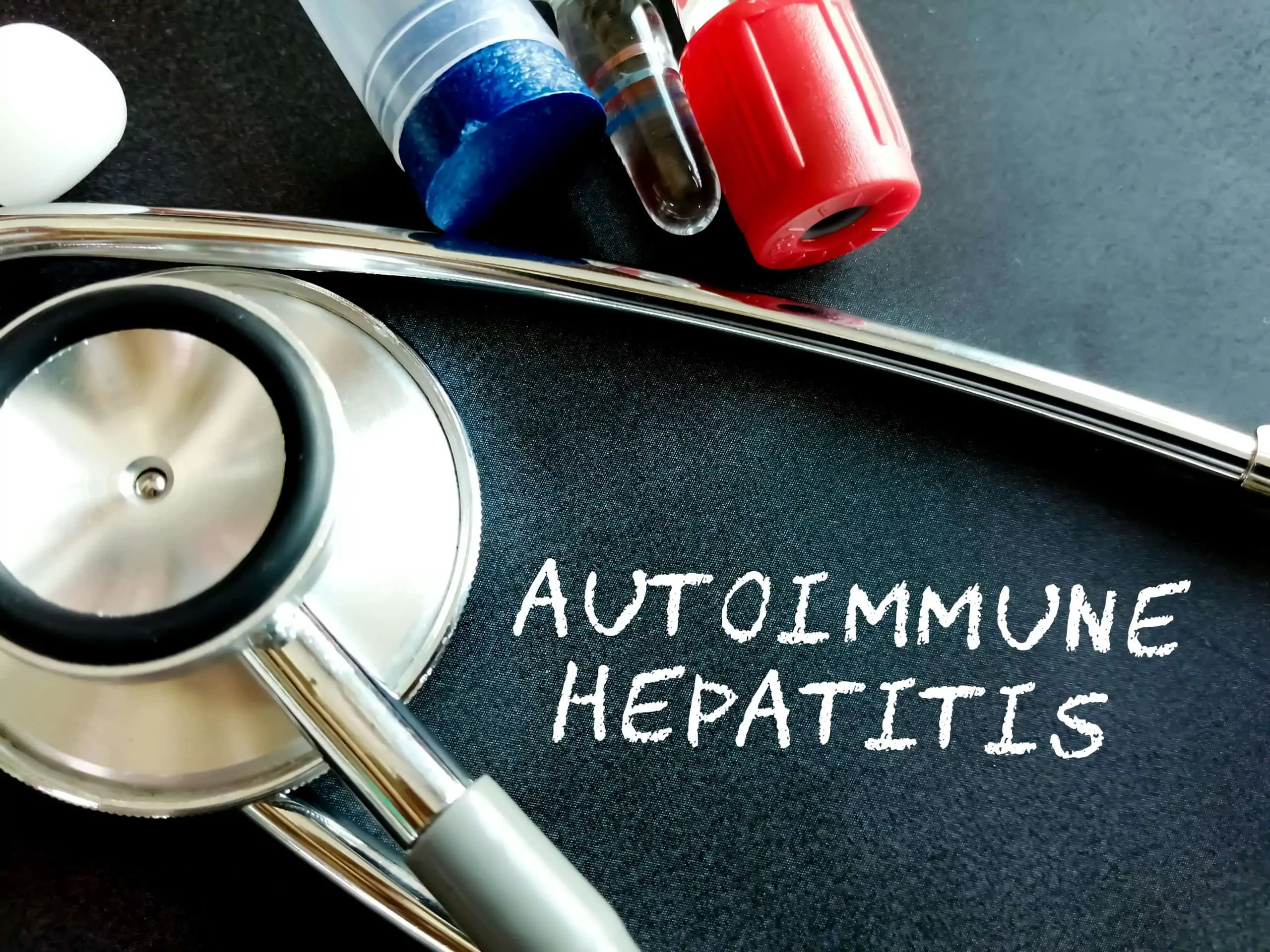 autoimuni hepatitis - uzrok, simptomi, liječenje