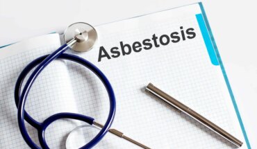 azbestoza – uzrok, simptomi, liječenje