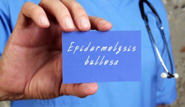 bulozna epidermoliza – uzrok, simptomi, liječenje