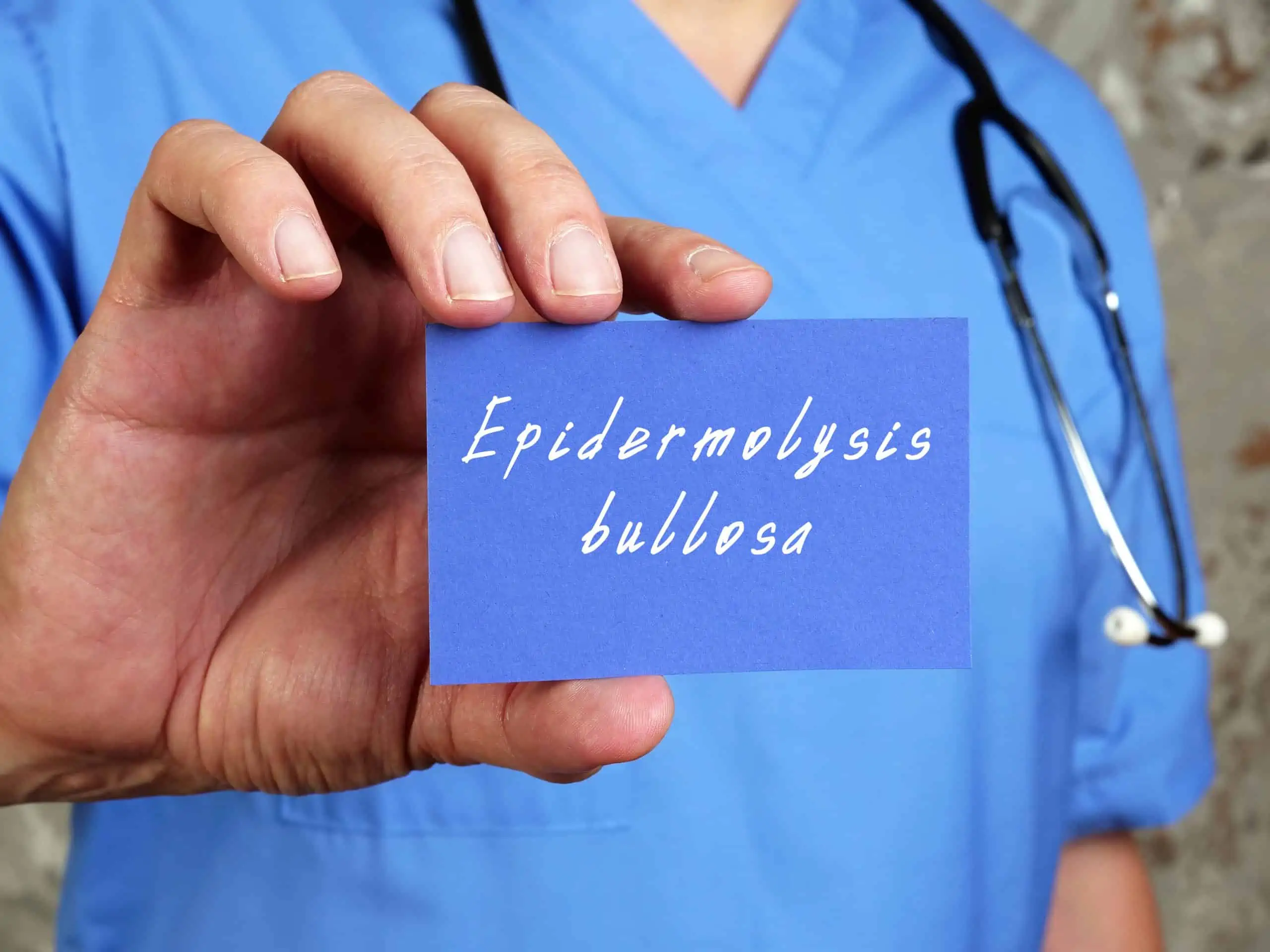 bulozna epidermoliza - uzrok, simptomi, liječenje