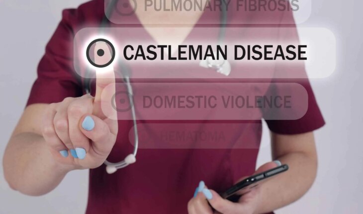 castlemanova bolest – uzrok, simptomi, liječenje