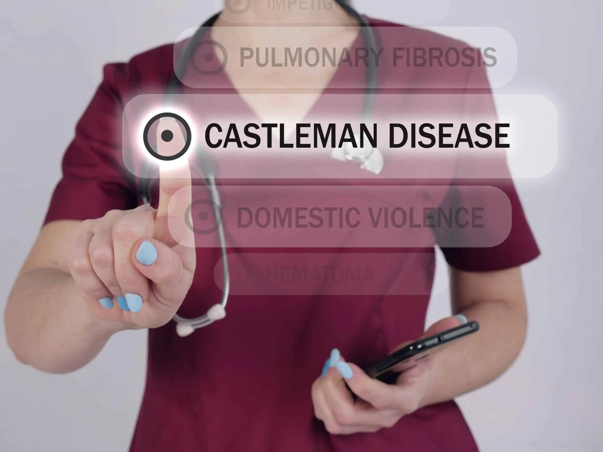 castlemanova bolest - uzrok, simptomi, liječenje