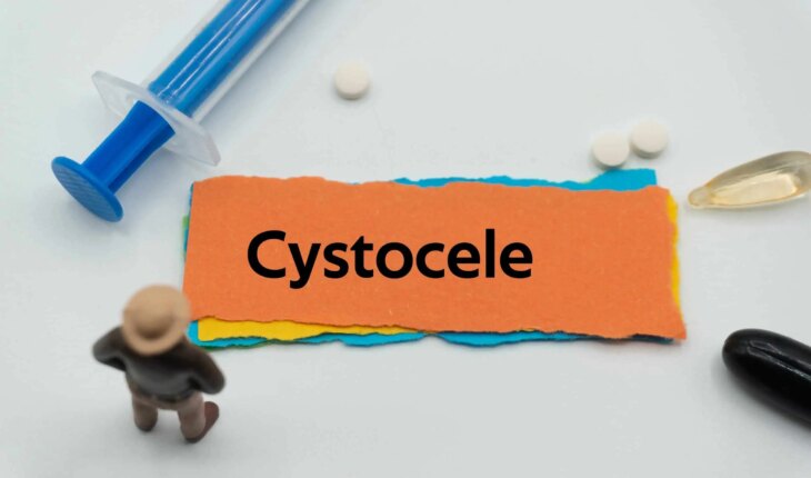 cistocela – uzrok, simptomi, liječenje