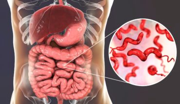 crijevne zarazne bolesti – općenito – uzrok, simptomi, liječenje