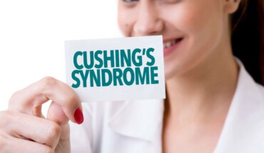 cushingov sindrom – uzrok, simptomi, liječenje