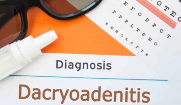 dakrioadenitis – uzrok, simptomi, liječenje