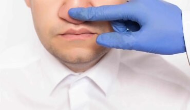 deformacija nosne pregrade – uzrok, simptomi, liječenje