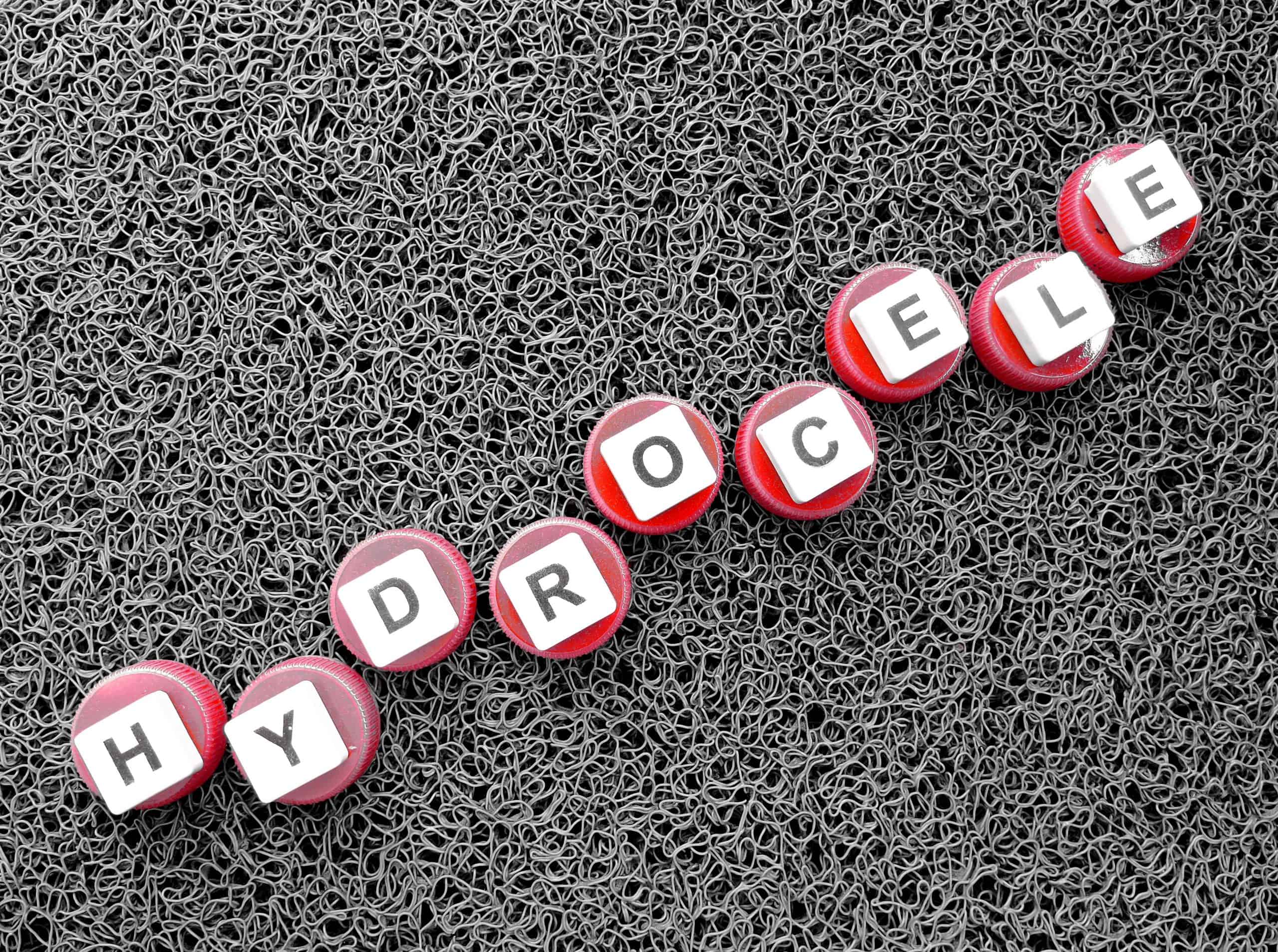 hidrokela - uzrok, simptomi, liječenje