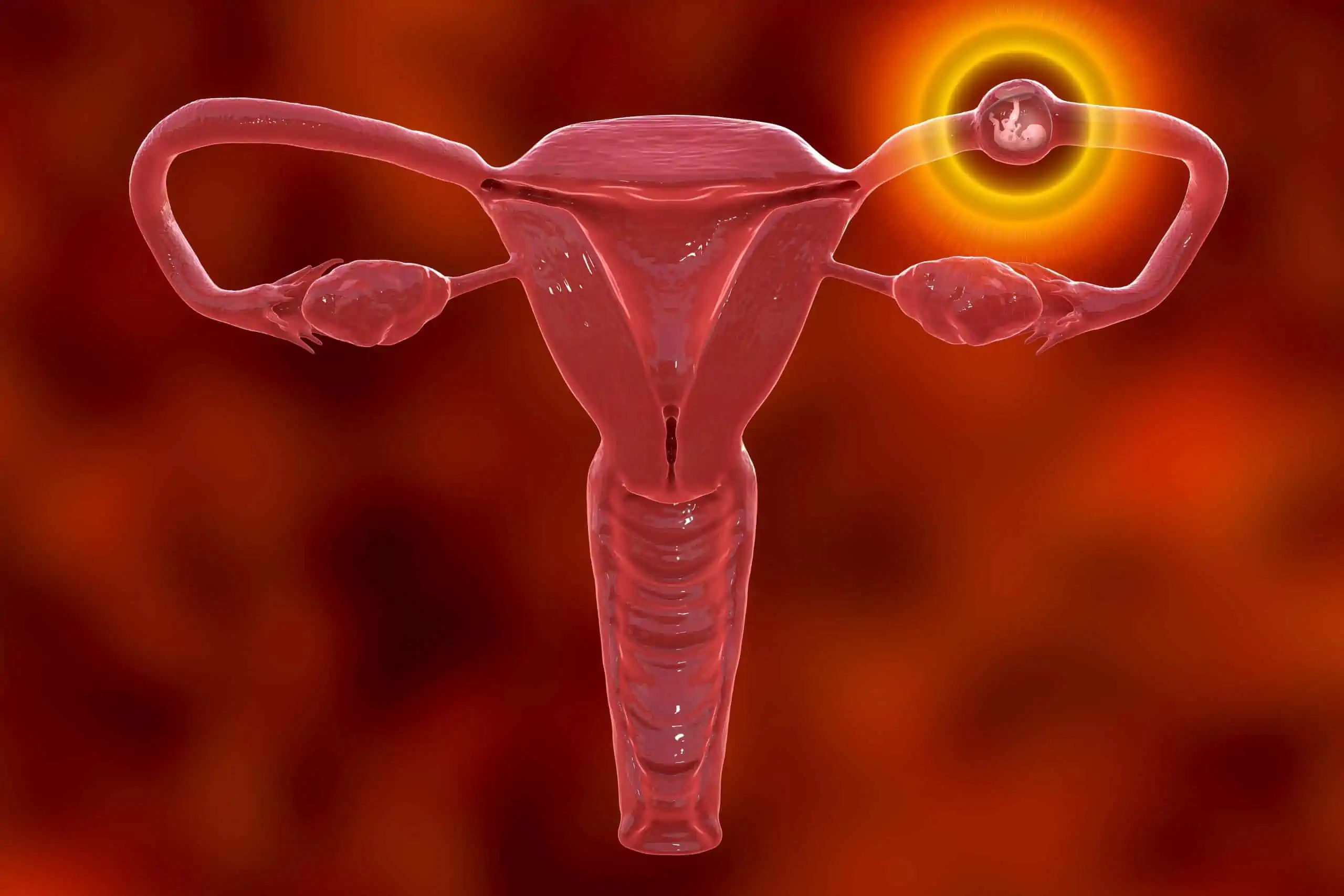 izvanmaternična trudnoća - što je i kako do nje dolazi