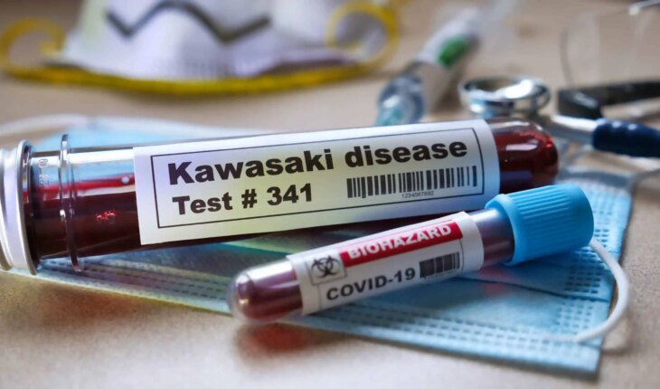 kawasakijeva bolest – uzrok, simptomi, liječenje