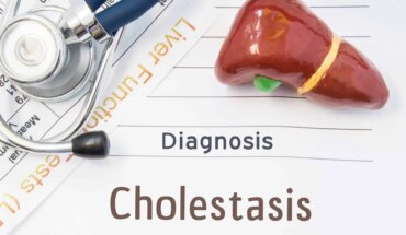 kolestaza u trudnoći – uzrok, simptomi, liječenje