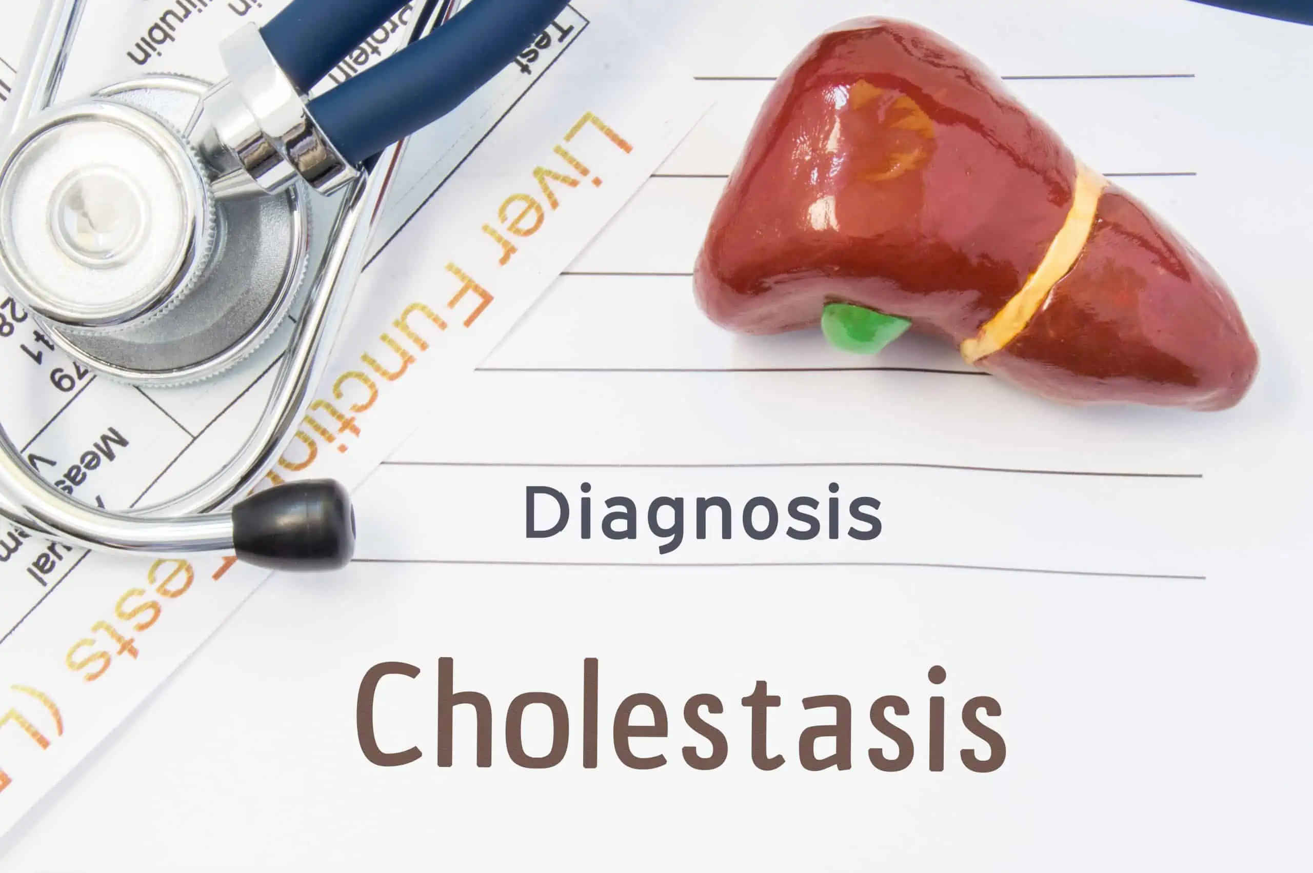 kolestaza u trudnoći - uzrok, simptomi, liječenje