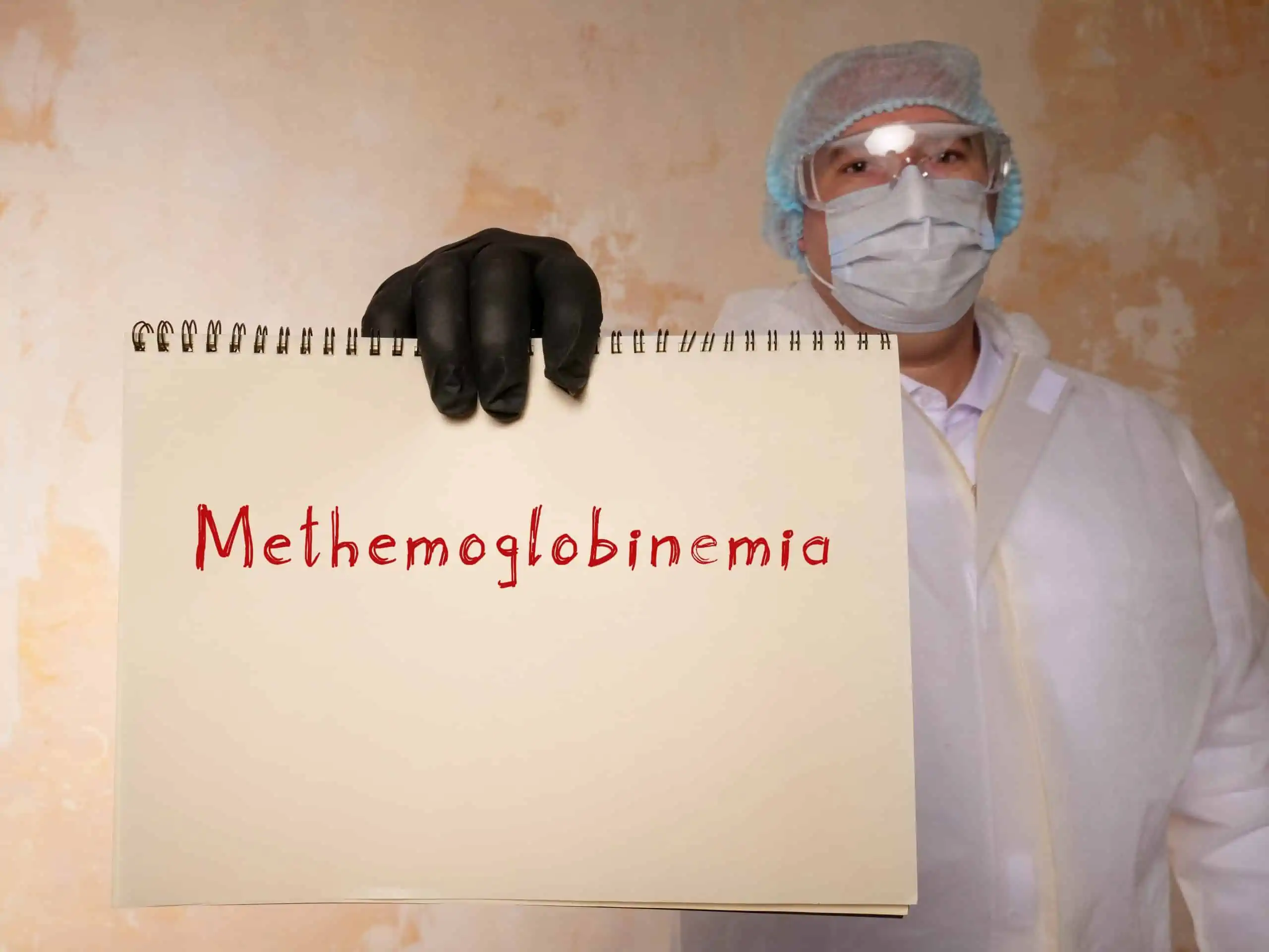 methemoglobinemija - uzrok, simptomi, liječenje