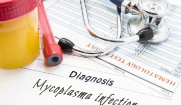 mycoplasma hominis – uzrok, simptomi, liječenje