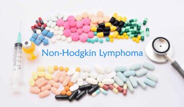 ne-hodgkinovi limfomi – uzrok, simptomi, liječenje