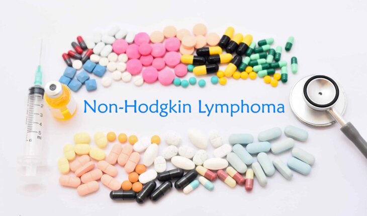 ne-hodgkinovi limfomi – uzrok, simptomi, liječenje