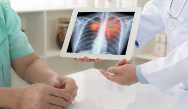 rak pluća – uzrok, simptomi, liječenje
