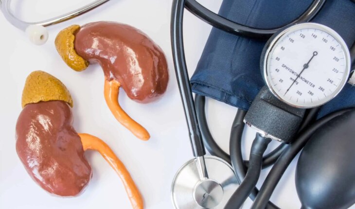 renovaskularna hipertenzija – uzrok, simptomi, liječenje