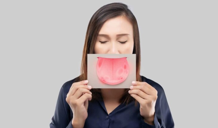 sindrom gorućih usta – uzrok, simptomi, liječenje
