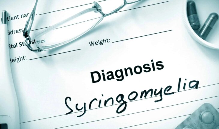 siringomijelija – uzrok, simptomi, liječenje
