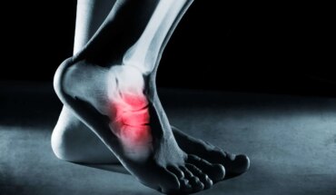 slomljeno stopalo (gležanj) – uzrok, simptomi, liječenje