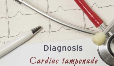 srčana tamponada – uzrok, simptomi, liječenje