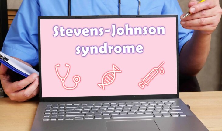 stevens johnsonov sindrom – uzrok, simptomi, liječenje
