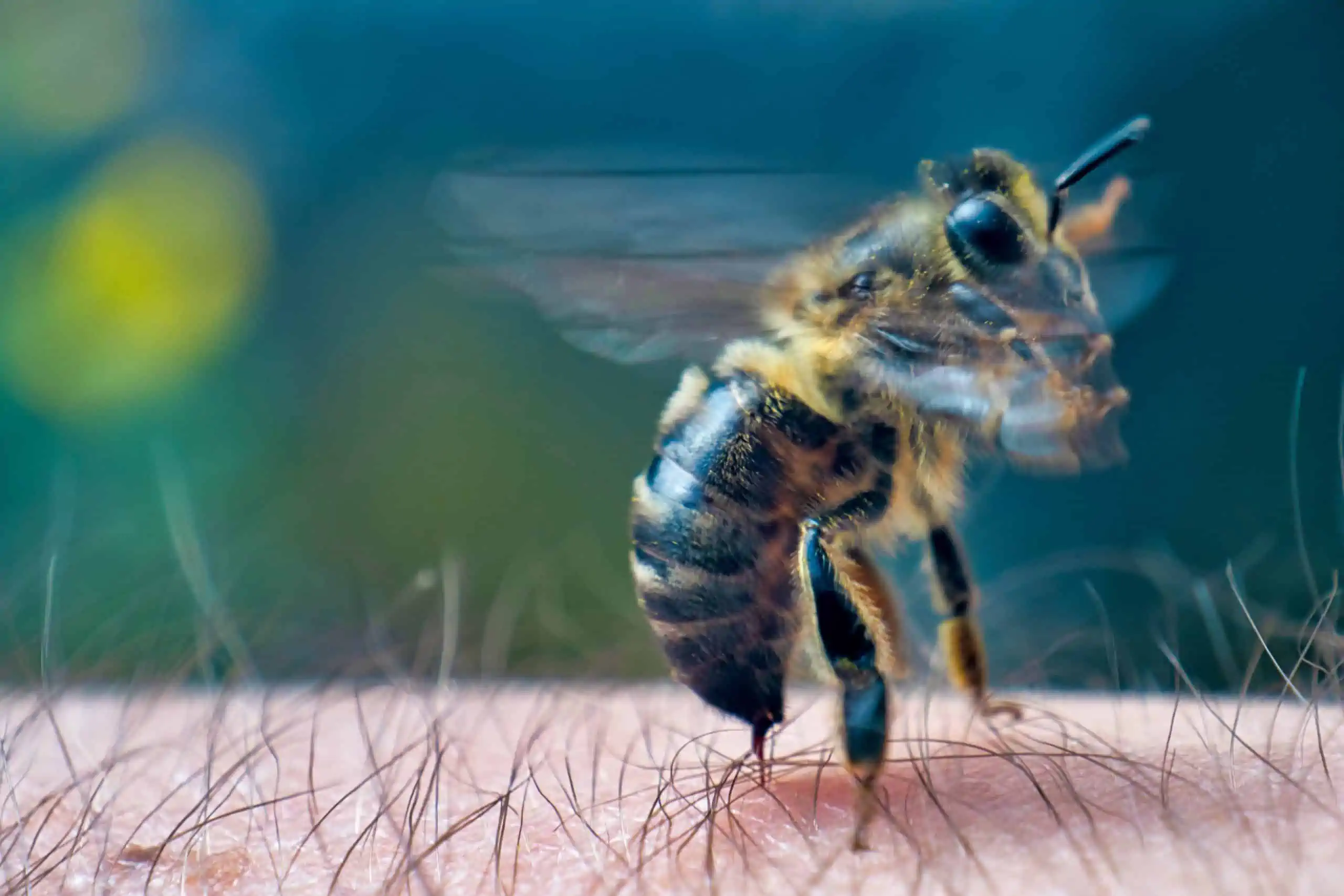 ubodi pčele - simptomi i liječenje