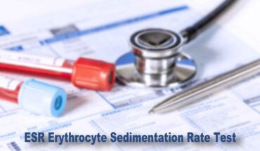što je esr (erythrocyte sedimentation rate)