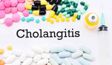 što je kolangitis – uzrok, simptomi, liječenje