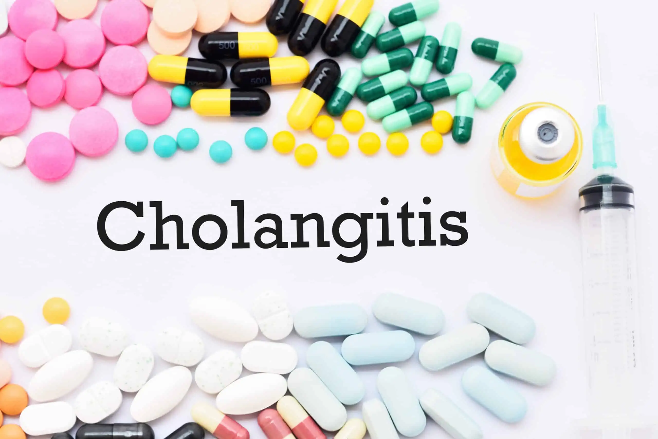 što je kolangitis - uzrok, simptomi, liječenje