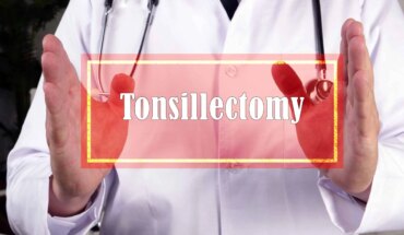 što je tonzilektomija – arz.hr