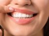 što je zubna caklina?