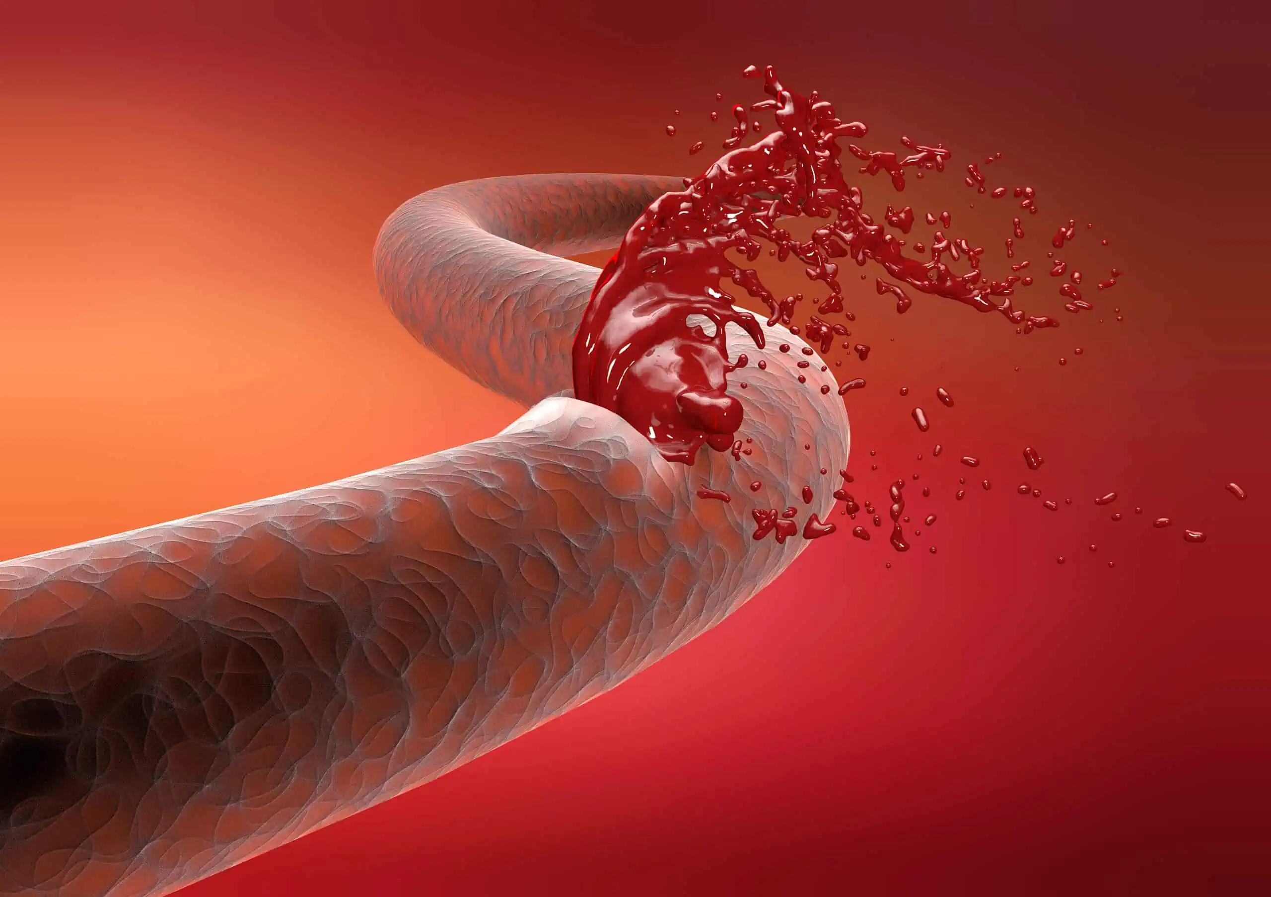 kako otkriti i zaustaviti arterijsko i vensko krvarenje