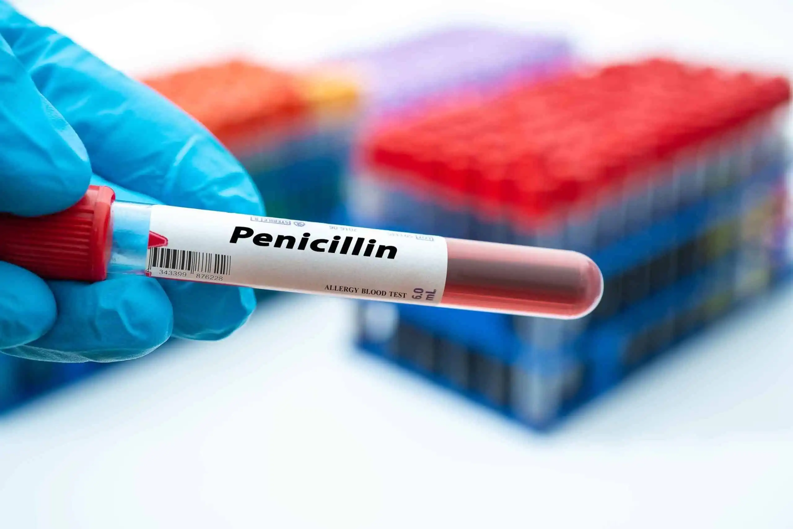 kako prepoznati alergiju na penicilin