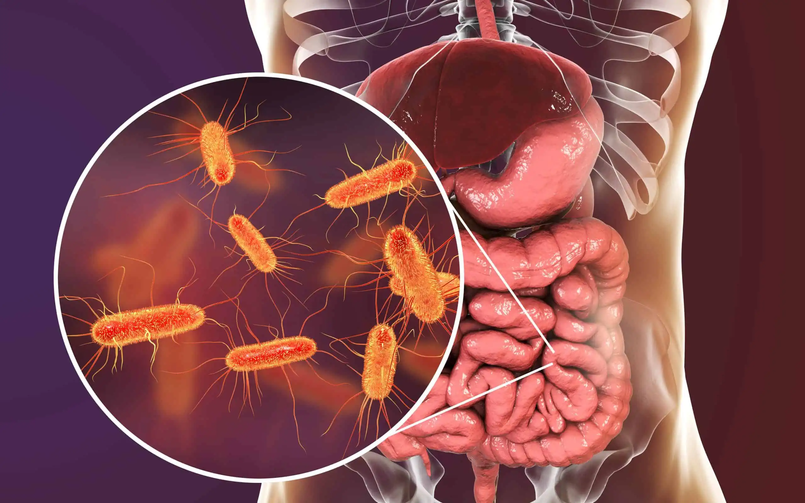 koje bolesti uzrokuje escherichia coli