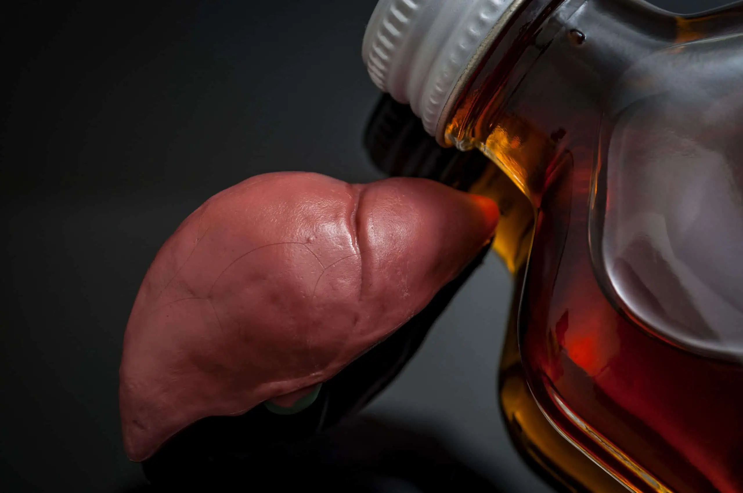 Bolesti jetre od alkohola – simptomi i liječenje