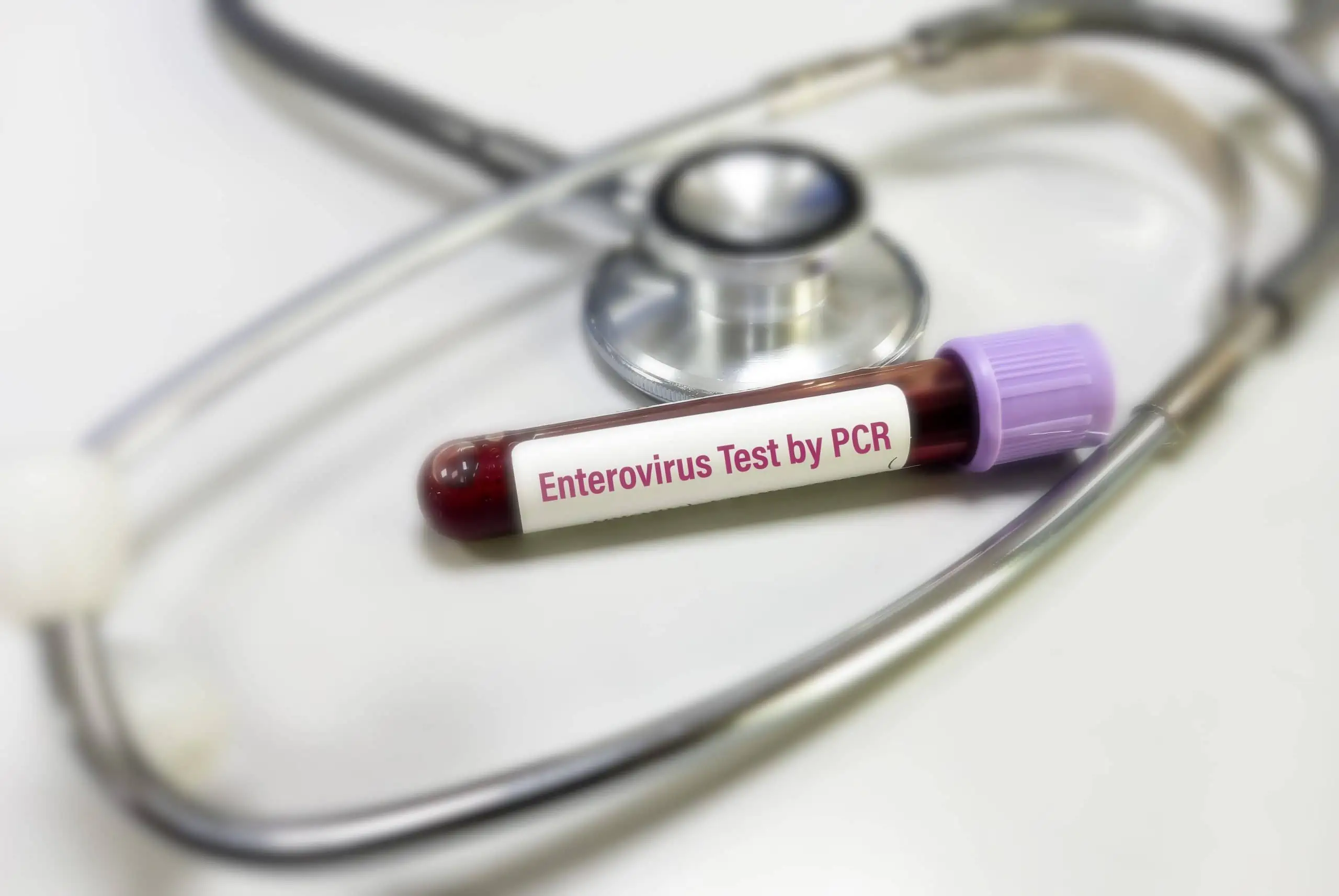 Enterovirus – uzrok, simptomi, liječenje