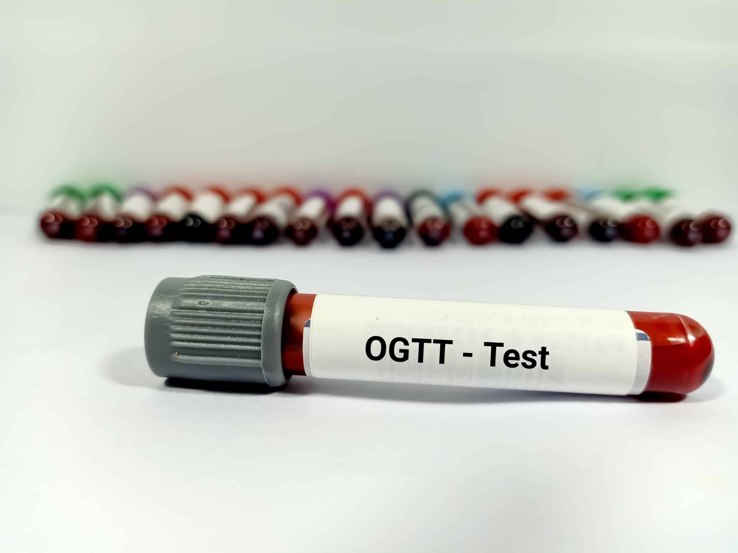 Kada se radi ogtt test