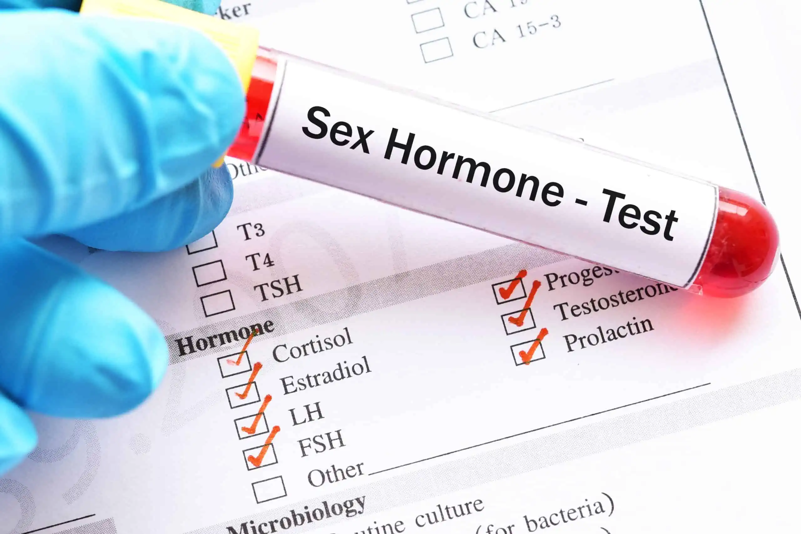 Kada se vade spolni hormoni