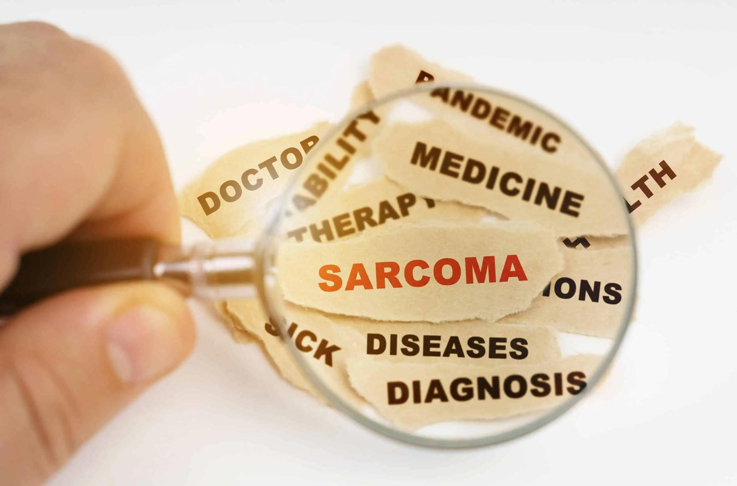 sarkom - uzrok, simptomi, liječenje