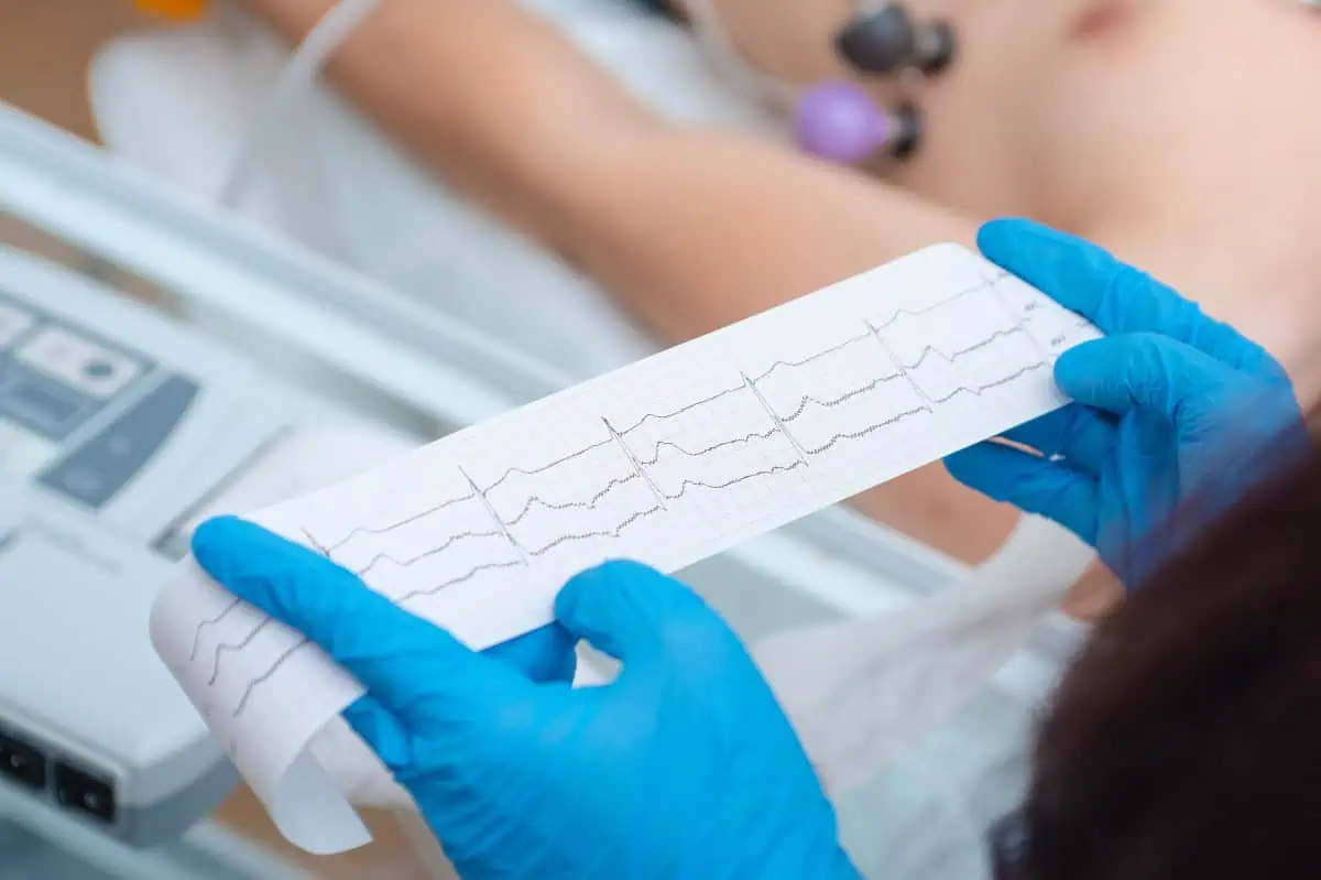 Ekg kako se radi – AdresarSporta.rs