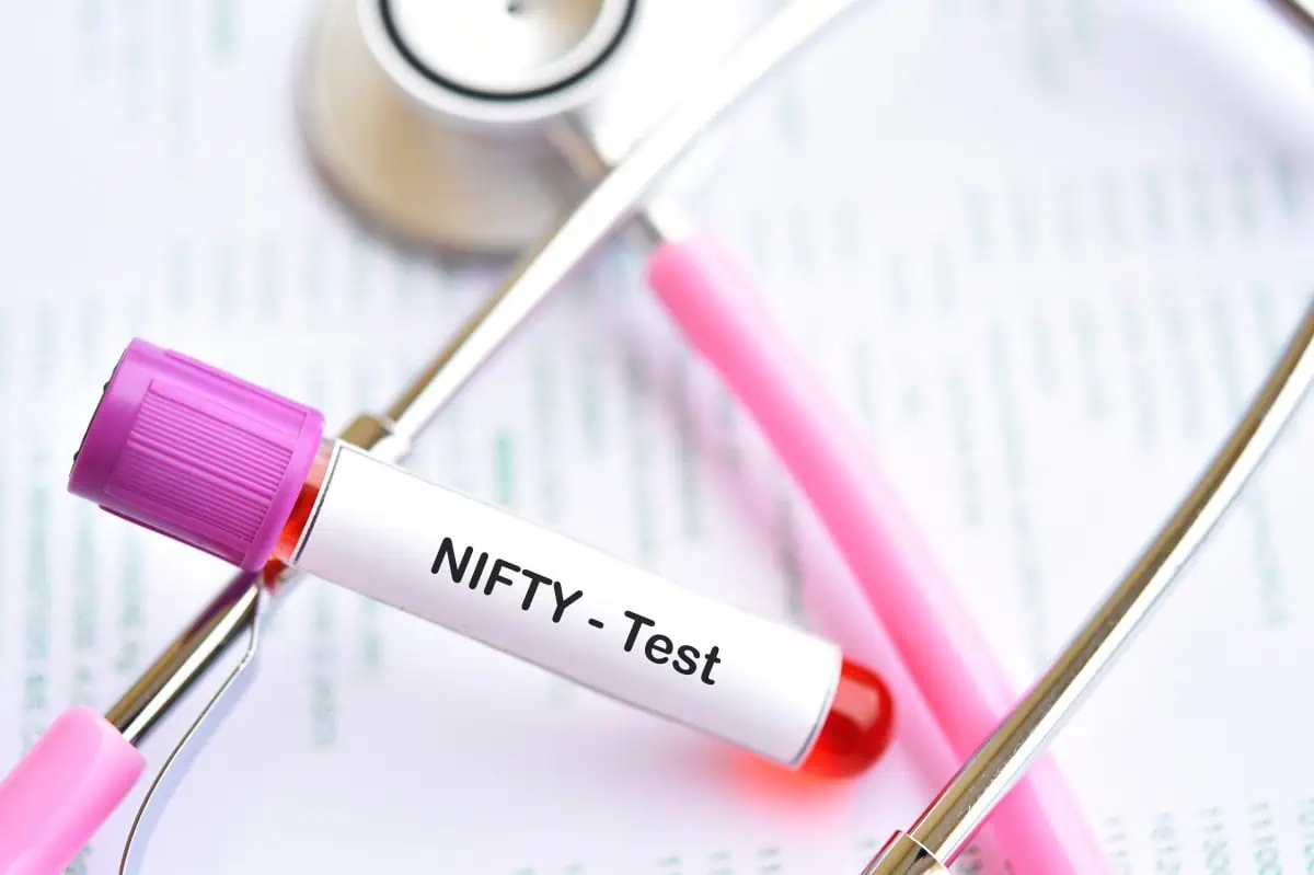 Nifty test kako se radi