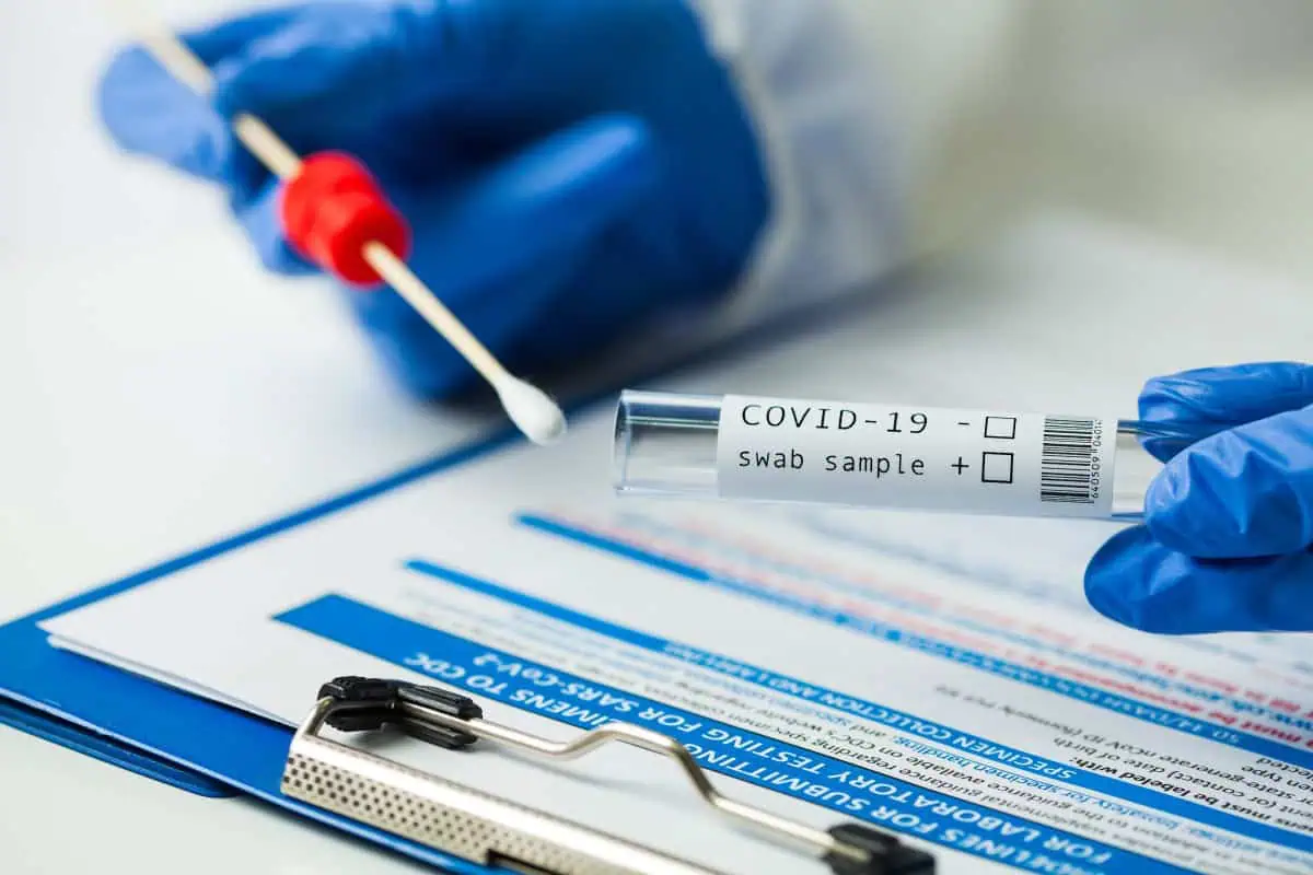 Gdje se možeš testirati na COVID-19?
