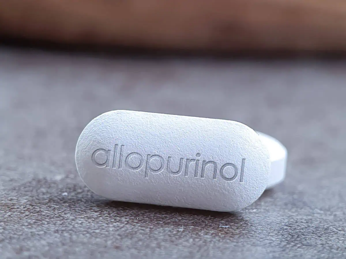 Kada treba uzimati alopurinol – AdresarSporta.rs